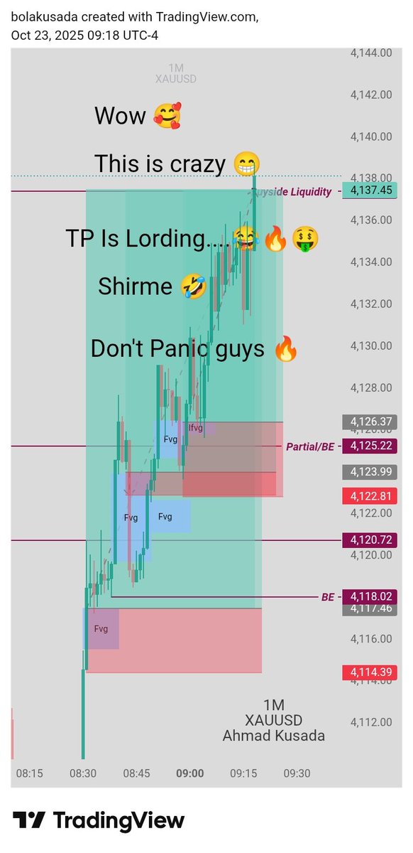 Today I Traded Gold Live And It Was Very Nice And Beautiful Guys 🔥🤑😎
