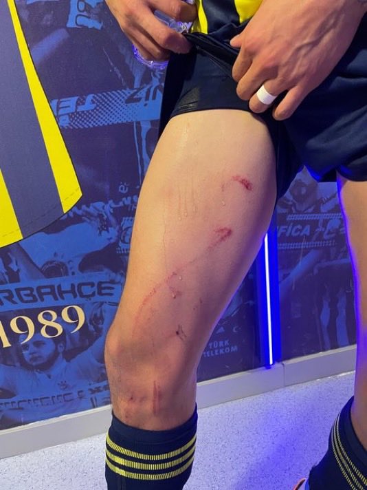 Jakob Kehlet’in yönettiği #Fenerbahçe– #Stuttgart maçı, hakem adaletinin sorgulandığı bir karşılaşma oldu.
Aynı pozisyonlarda farklı kararlar, göz göre göre kaçan fauller…
Futbolun ruhunu bozan bu tür yönetimlere artık bir dur denmeli...
#FBvSTU #UEFA #FİFA
<a href="/EuropaLeague/">UEFA Europa League</a>