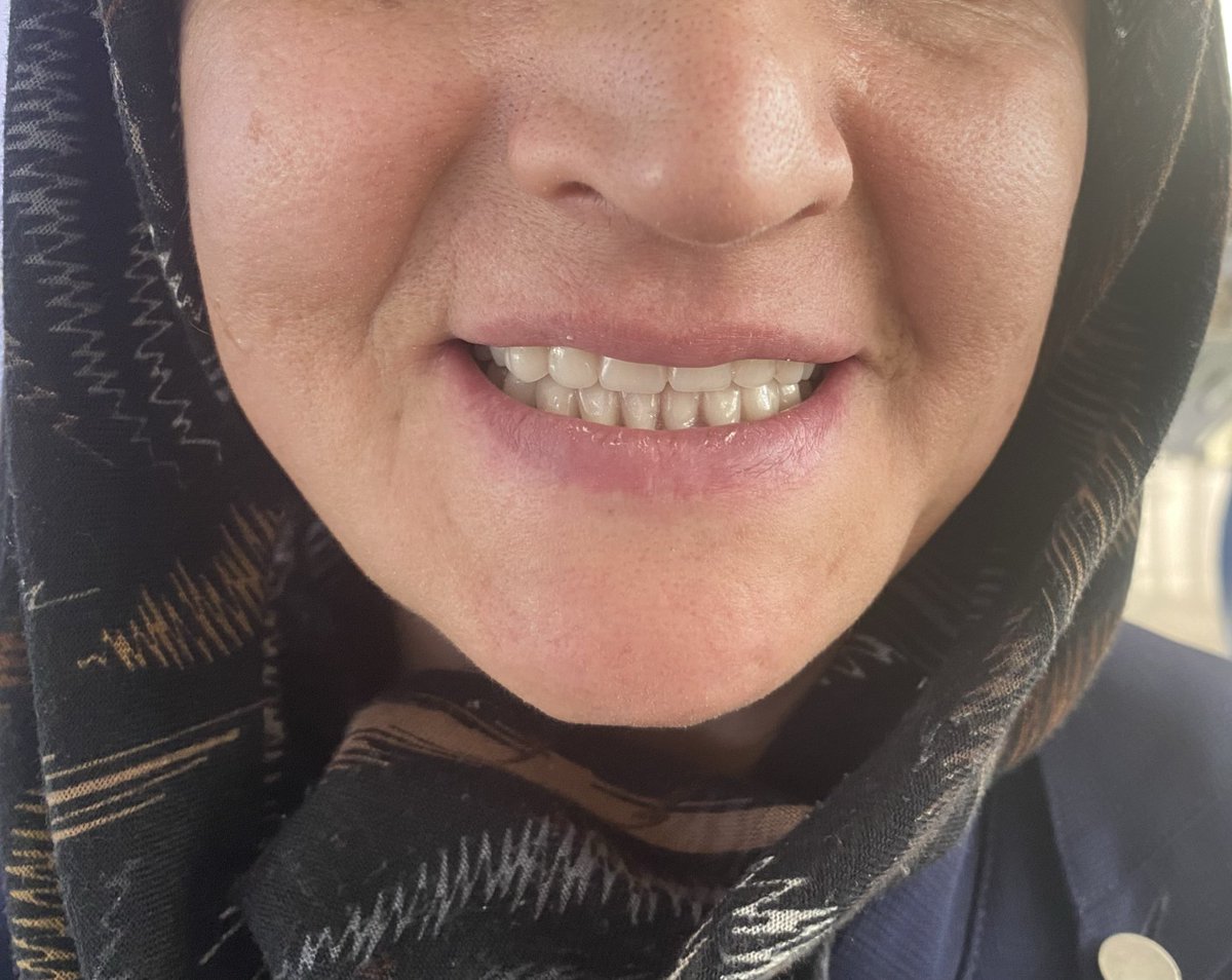 ilk bitimimi yaptım bi hayırlı olsun alırız artık