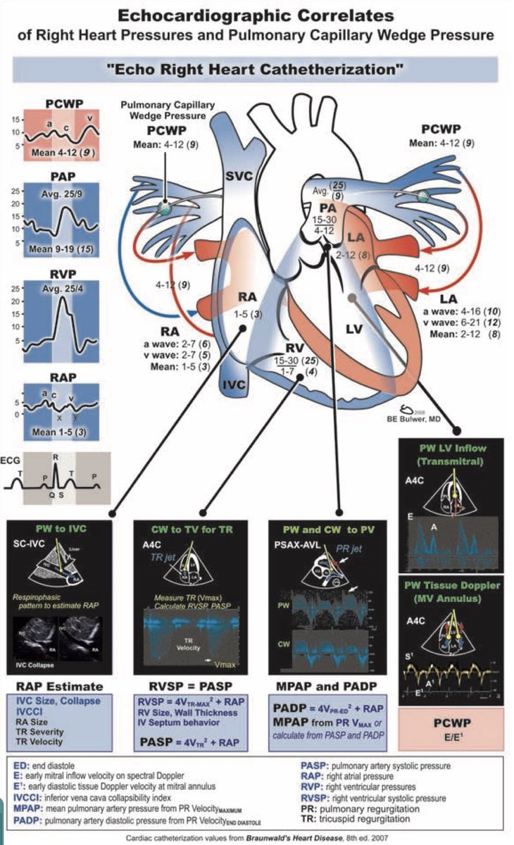 TrackYourHeart's tweet photo. Understanding Right Heart Cath: Echo-Derived Hemodynamics Simplified😍 https://t.co/H2VsZEXr5c