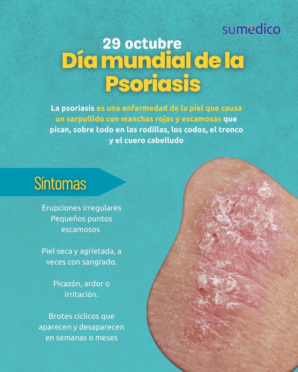 sumedico's tweet image. 📅 29 de octubre | #DíaMundialDeLaPsoriasis 🌍💛
Hoy hablamos de la psoriasis, una enfermedad crónica que afecta la piel y la autoestima. Es clave informar, concienciar y apoyar a quienes la viven. 💪
#Psoriasis #SaludDeLaPiel