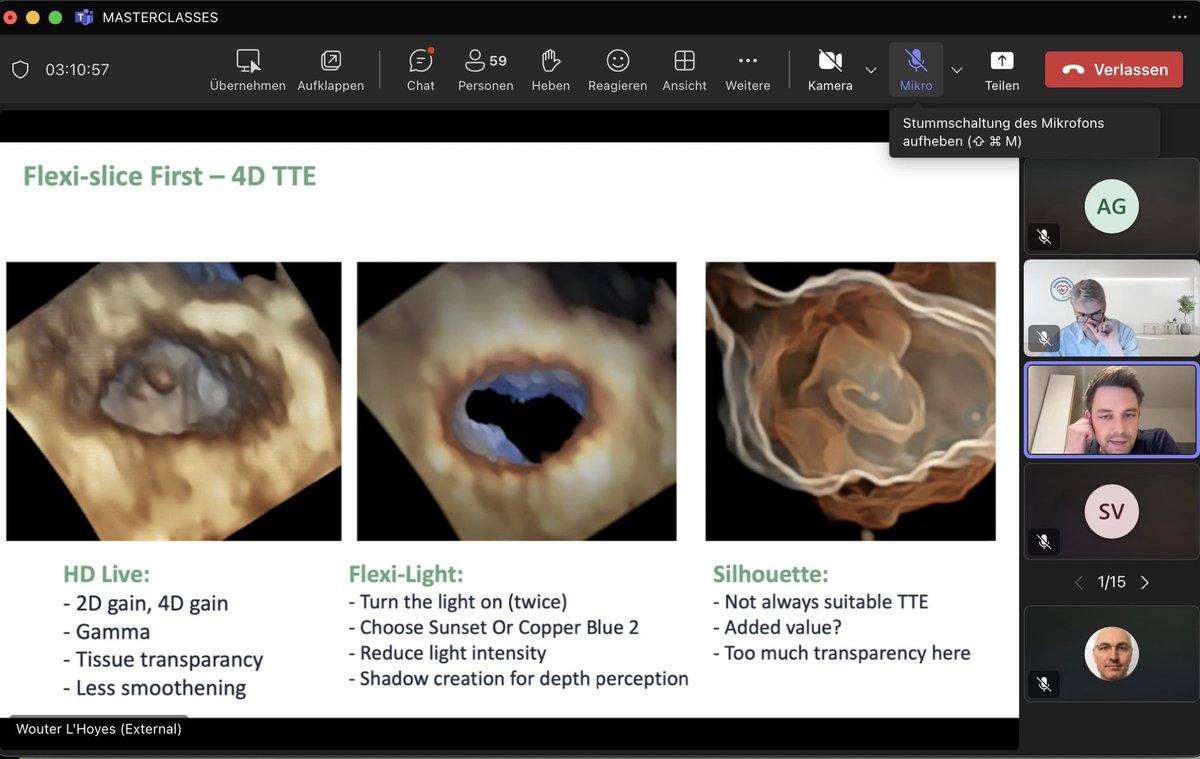 alex1708ander's tweet photo. Pure bliss from a master @LHoyesWouter 🌟🌟Thank you for sharing your knowledge and giving us a valuable and detailed insight on how to improve our skills in 4D echo🙏🙏 @VerwerftJan @HartcentrumH #echofirst https://t.co/43RY9iM0UF