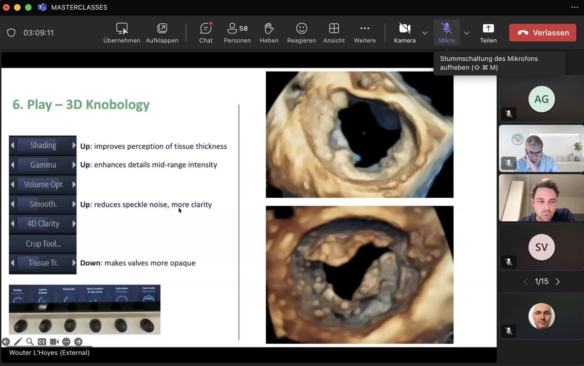alex1708ander's tweet photo. Pure bliss from a master @LHoyesWouter 🌟🌟Thank you for sharing your knowledge and giving us a valuable and detailed insight on how to improve our skills in 4D echo🙏🙏 @VerwerftJan @HartcentrumH #echofirst https://t.co/43RY9iM0UF