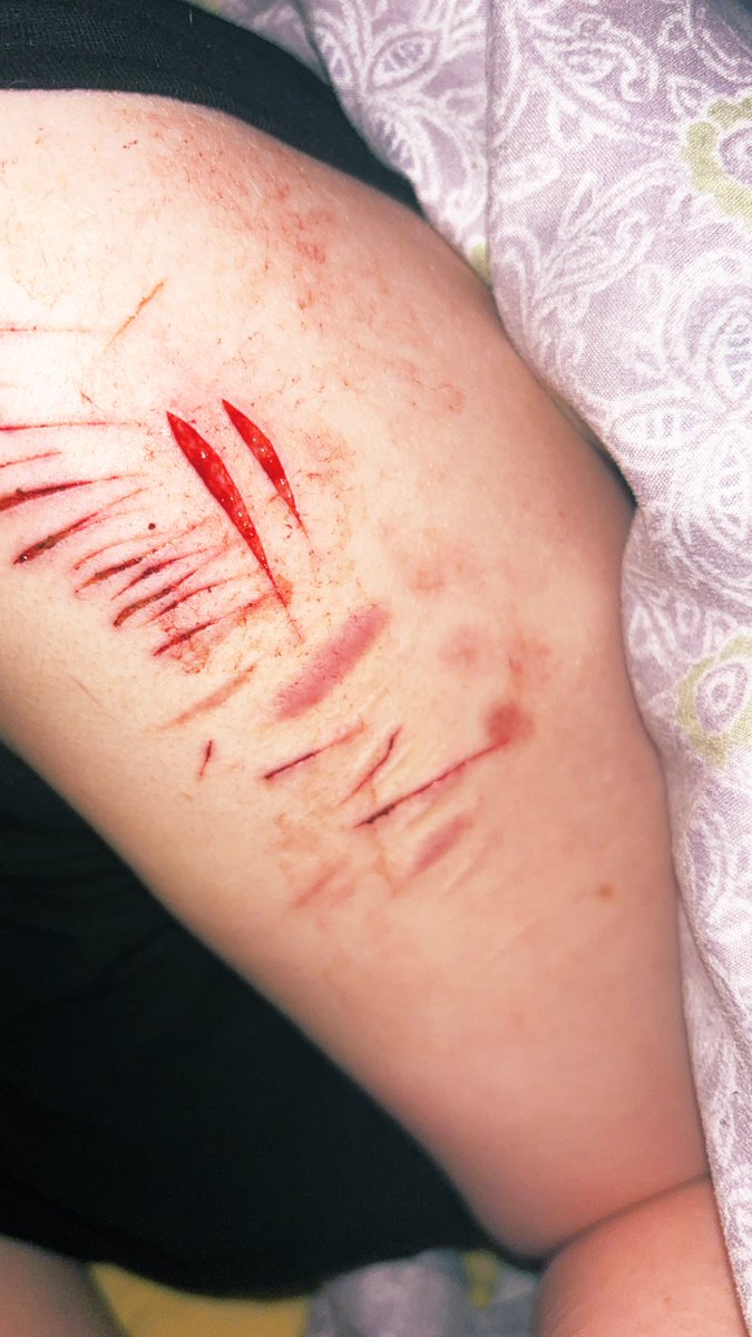 relapse from this morning.
im quite disappointed with myself T-T 
#shtwt