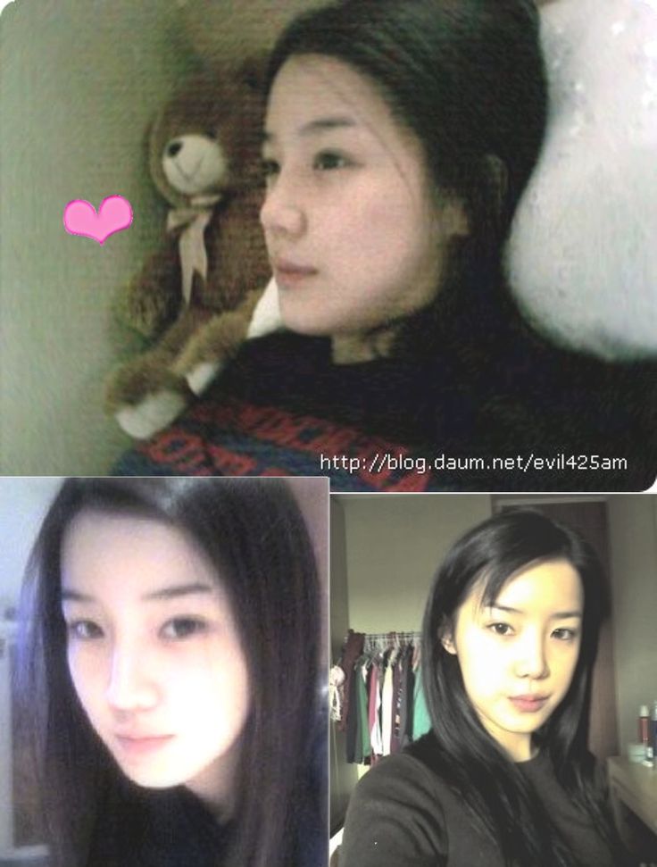 Every time I ask myself,  she was  so beautiful 
 why she  need to do  plastic surgery?
If a YG  forces her  to do plastic surgery then she so right to sue them