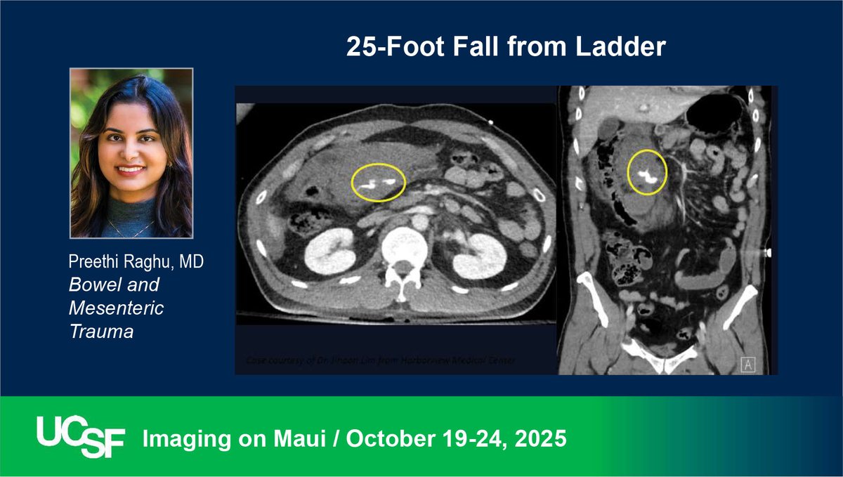 UCSF Abdominal Faculty Dr. Preethi Raghu reviews Bowel Trauma at our CME course on MAUI.