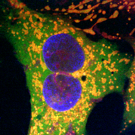 #CysticFibrosis is hard to treat with gene therapy because it can be caused by many different combinations of mutations. A new gene editing tech from <a href="/UTAustin/">UT Austin</a>, using genetic elements borrowed from bacteria, might change that. Full story: cns.utexas.edu/news/research/…