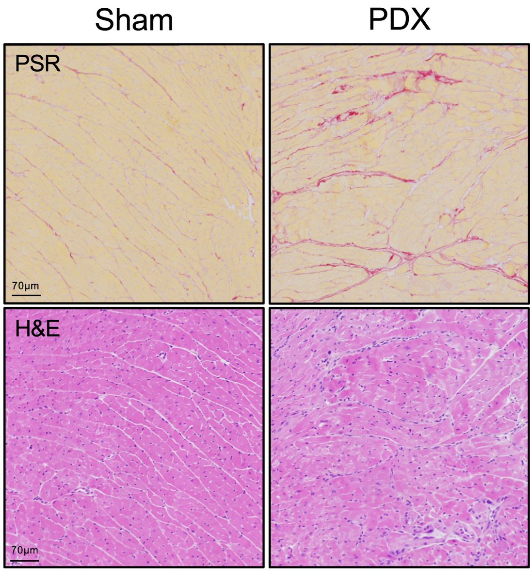 AJPathology's tweet image. #LegacyContent: Cardiac Atrophy, Dysfunction, and Metabolic Impairments: A Cancer-Induced Cardiomyopathy Phenotype.  Authors from @uofg, @YorkUniversity, @DalMedSchool
#OpenAccess text: ajp.amjpathol.org/article/S0002-…