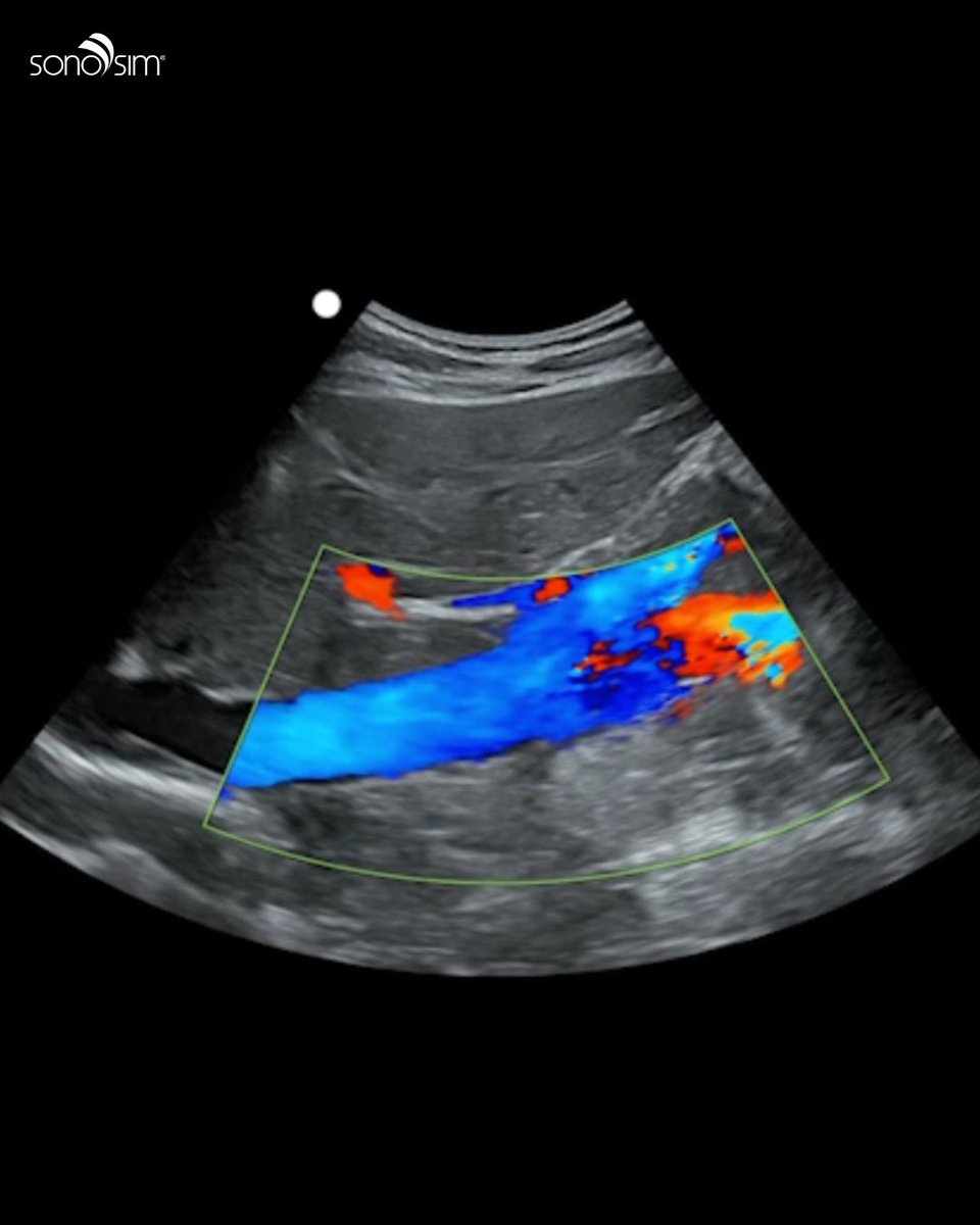 SonoSim, Inc tweet media