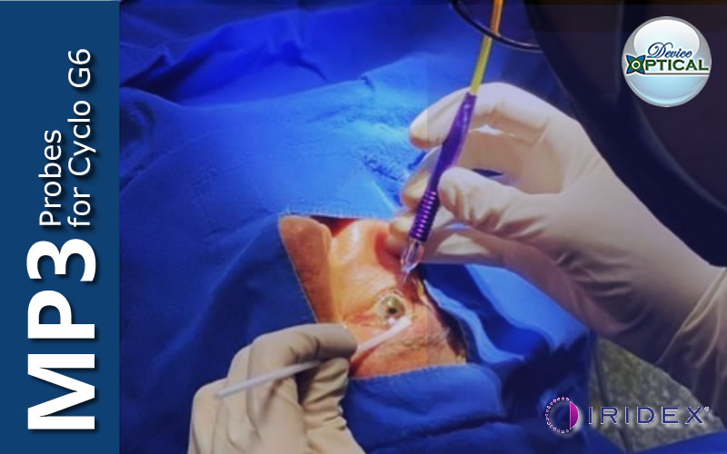 Device_Optical's tweet image. Presentamos la nueva sonda de IRIDEX MicroPulse P3® Rev2 Una combinación conveniente de seguridad, eficacia, durabilidad y repetibilidad en un enfoque no incisional para el cuidado del glaucoma. 
#oftalmologia #oftalmologo #profesionaldelasalud #oftalmo #retina #glaucoma