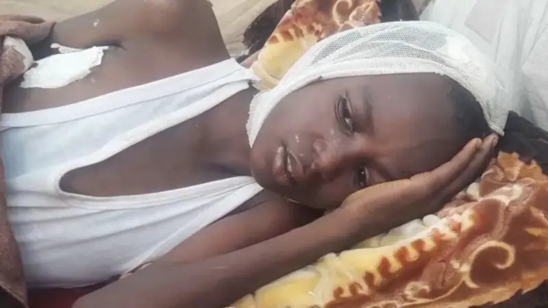 Mji wa Sudan umezingirwa: 'Mwili mzima wa mwanangu umejaa majeraha ya makombora'
bbc.in/471OCvb