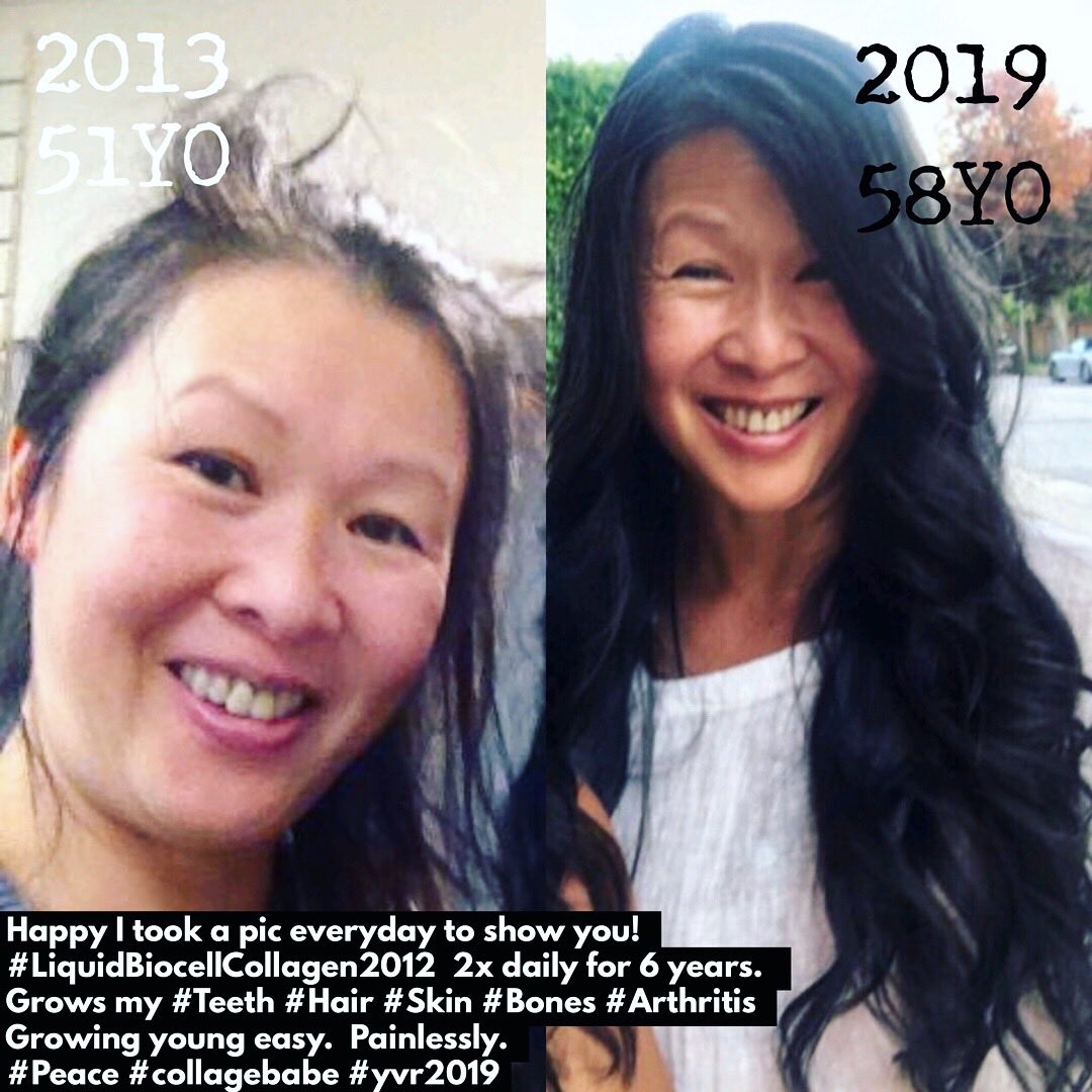 HumanDesignBabe's tweet photo. @CaryKelly11 @counselorcurtis Grew my teeth/hair 
w/#Collagen before 
I found #carnivore 2024.  
Ask to tell my stories.  
#60YOBoomer #ConcussionRecovery   #15Concussions 
Respectfully moneca.  
#CollagenBabe #SteaksAndCollagenBaby  #Biohacker  #Regenr8Brain 
w/ #liquidbiocellcollagen2012
🙏🧠❤️🥩🇨🇦✨💃🏻💋 https://t.co/Mxq2HhmnBU