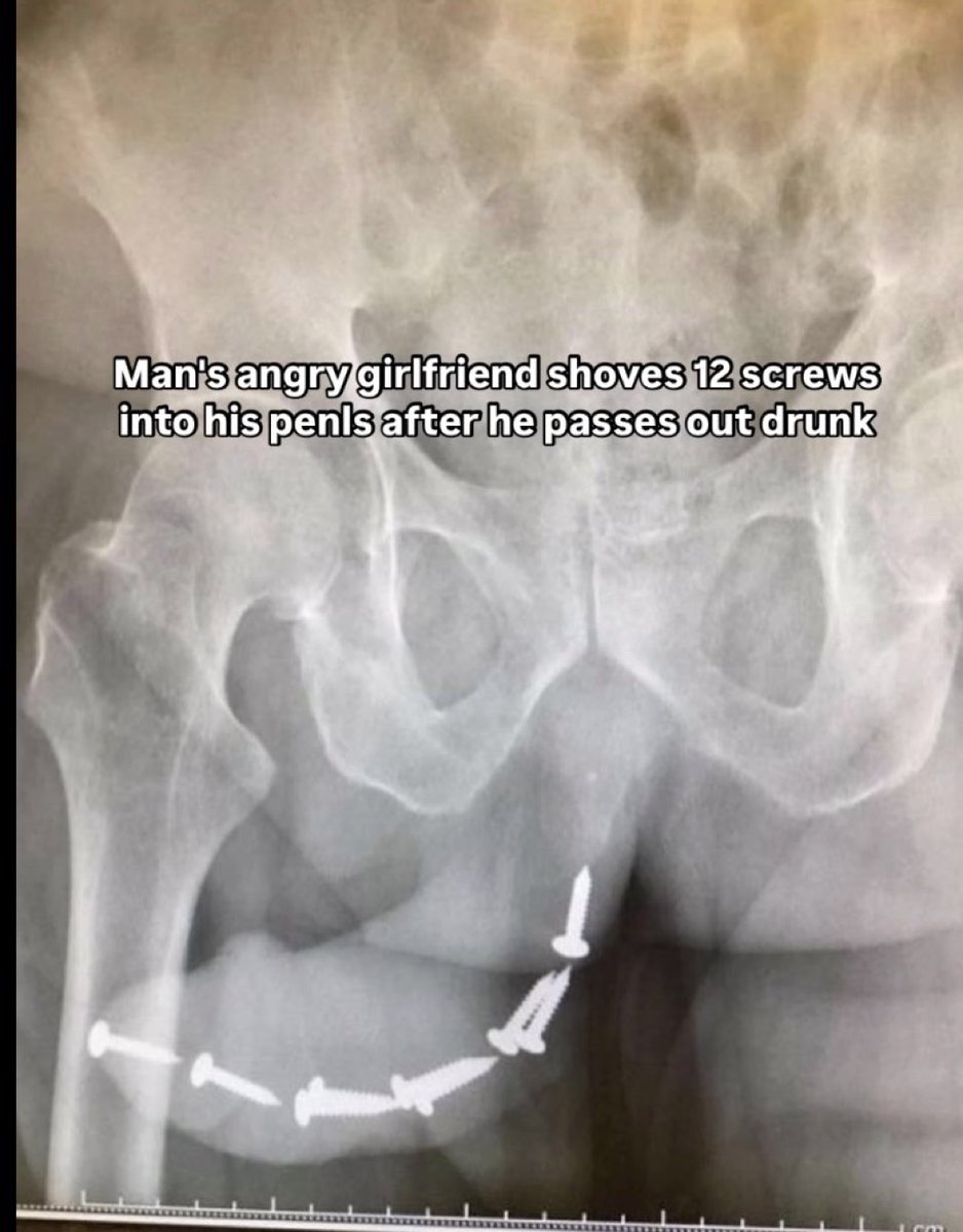 Alphafox78's tweet image. There are some things more painful than child birth: 😨