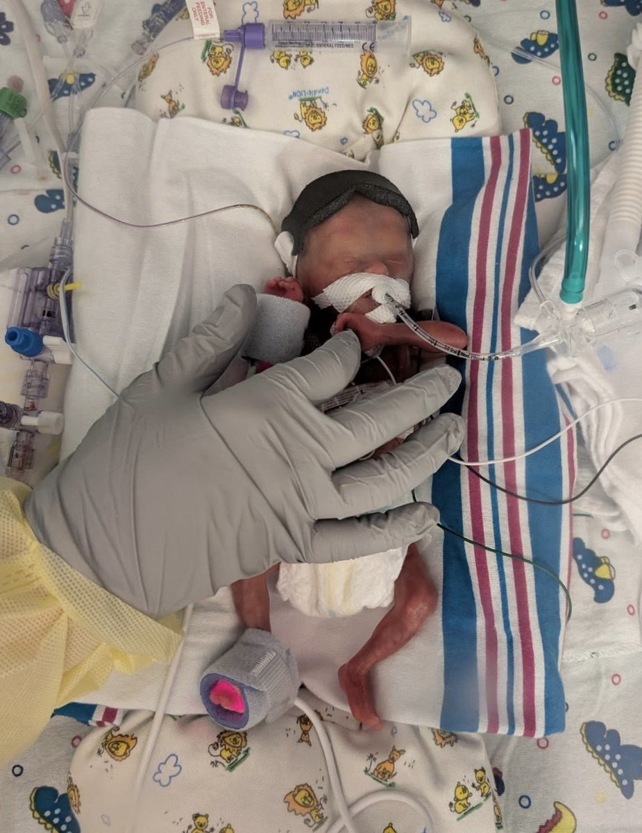 Blog_Mickey's tweet photo. Also! Bret became a father on October 3rd when Kristen welcomed baby Brennan Bret into the world 💙

A perfect 23 weeks and 3 days, weighing in at a whopping 1lb and 9.5” long

They have a registry here: https://t.co/TtMchx01LH https://t.co/6AFlqvyhRm
