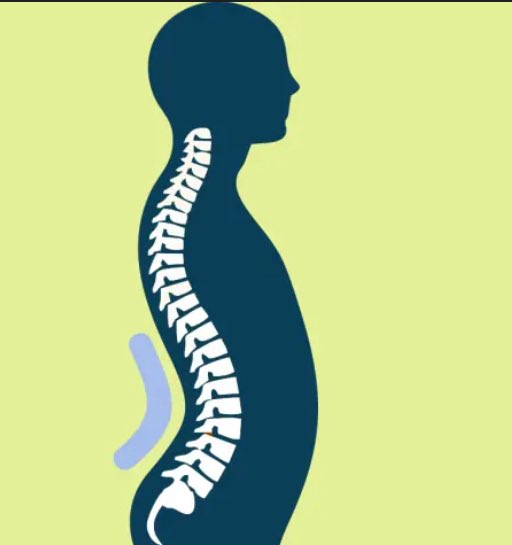 wilfezn's tweet image. she actually thick or just suffering from lumbar lordosis