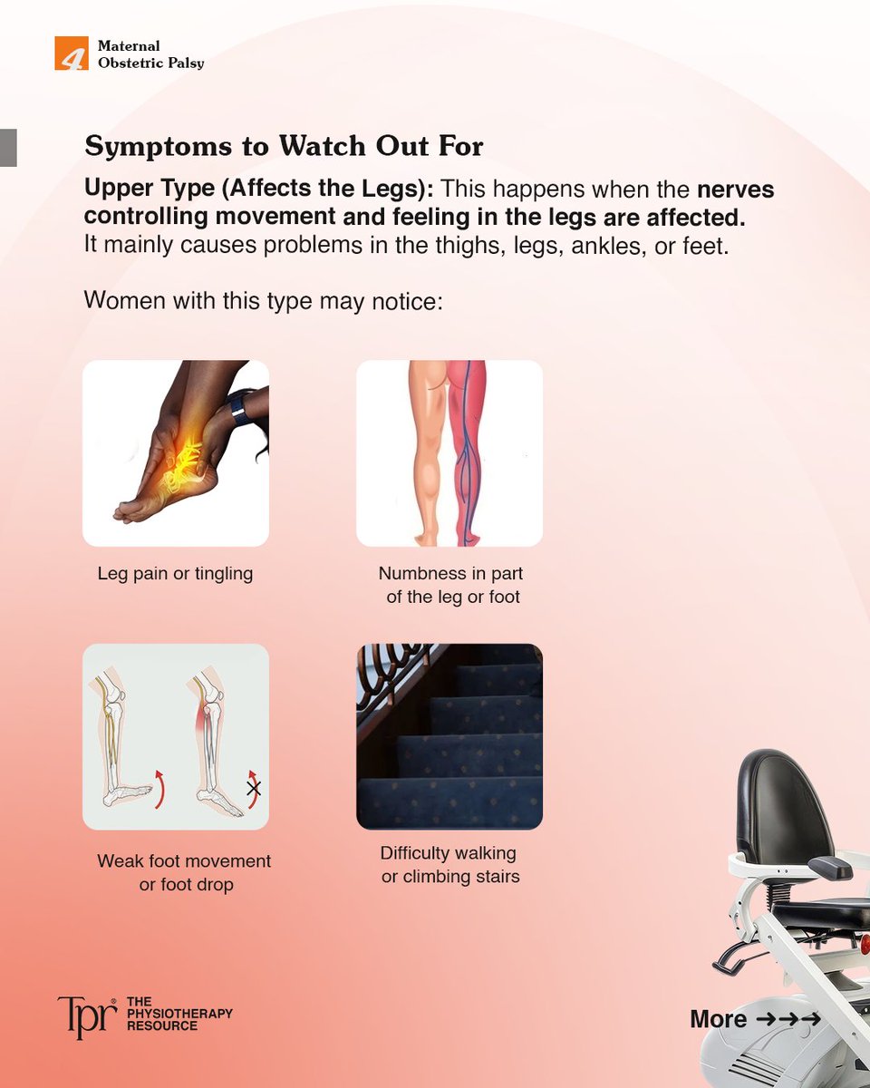 The_P_Resource's tweet photo. Maternal Obstetric Palsy (MOP) is nerve damage that can occur during or after childbirth, affecting the legs and pelvic area.

The good news is that treatment, primarily through physiotherapy, is highly effective, and most women recover within weeks or months.
Swipe to learn more https://t.co/FI6gBBgyH1