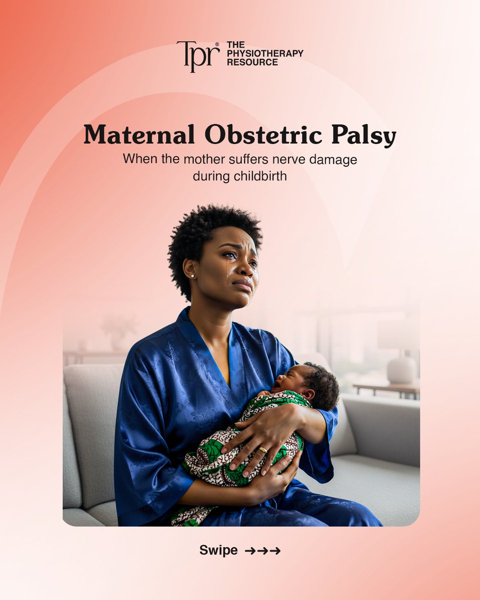 The_P_Resource's tweet photo. Maternal Obstetric Palsy (MOP) is nerve damage that can occur during or after childbirth, affecting the legs and pelvic area.

The good news is that treatment, primarily through physiotherapy, is highly effective, and most women recover within weeks or months.
Swipe to learn more https://t.co/FI6gBBgyH1