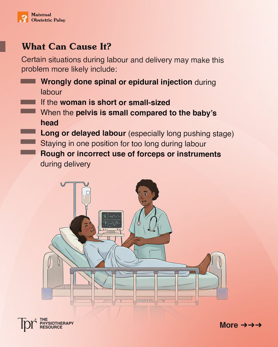 The_P_Resource's tweet photo. Maternal Obstetric Palsy (MOP) is nerve damage that can occur during or after childbirth, affecting the legs and pelvic area.

The good news is that treatment, primarily through physiotherapy, is highly effective, and most women recover within weeks or months.
Swipe to learn more https://t.co/FI6gBBgyH1
