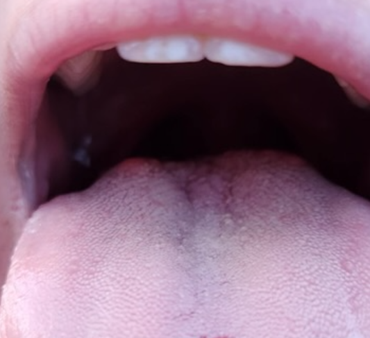 Emergency Medicine Case Challenge:
Fish Allergy: erpocketbooks.com/p3/