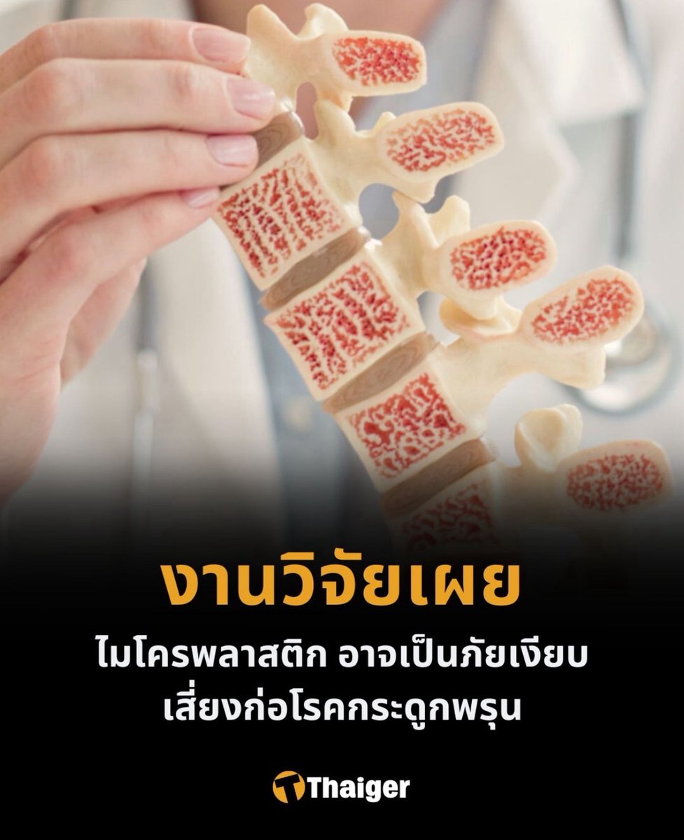 Garrdenrosse's tweet photo. การเลือกเครื่องกรองน้ำ สำคัญสุด #espring https://t.co/8mzgzUVPtI