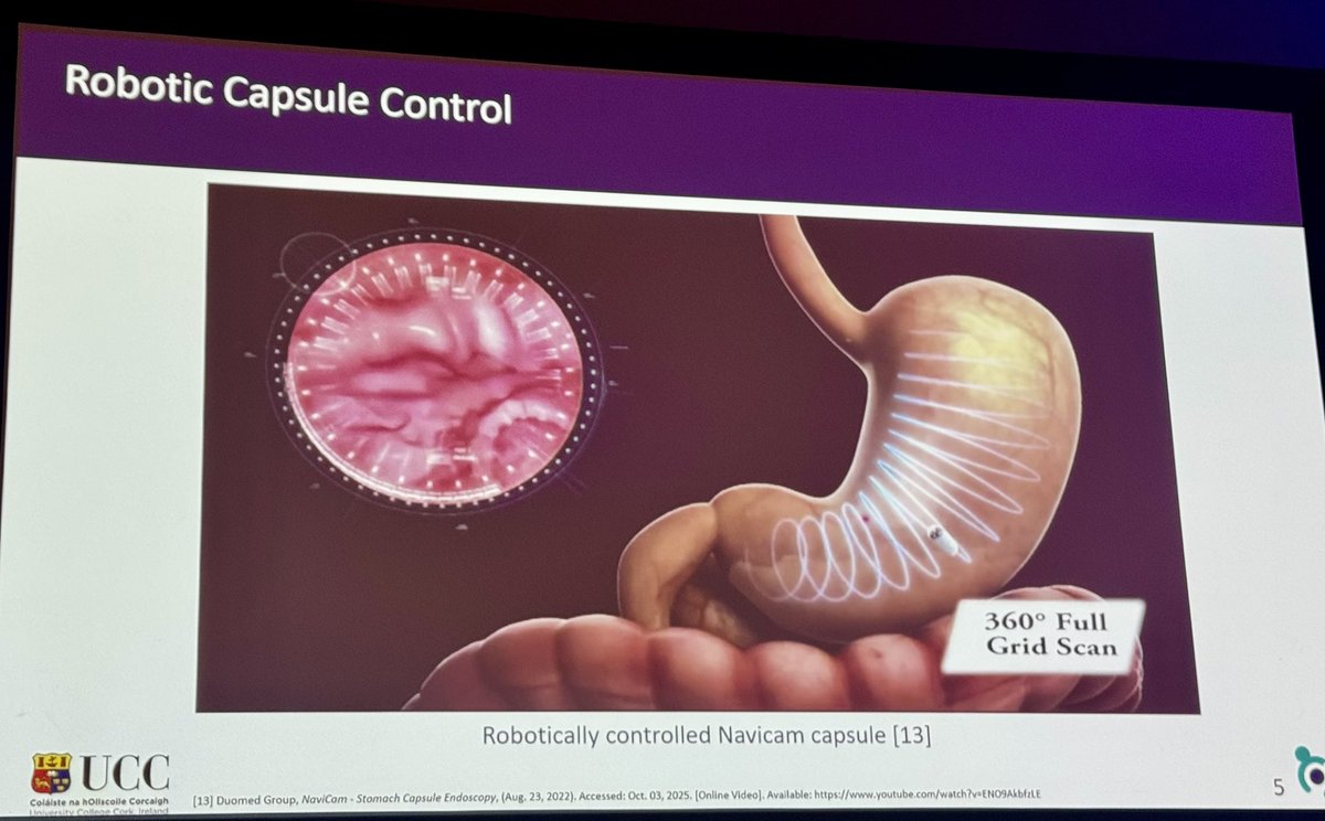 NeeraGuptaMD's tweet image. Dr Coombes: The Future of Capsule Endoscopy:
➡️ Real-time position tracking of the capsule
➡️ Time-stamping of position to video images 
#SMIT2025 #iSMIT2025 @ChildrensNatl #MedTech #WashingtonDC