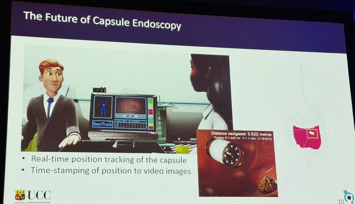 NeeraGuptaMD's tweet image. Dr Coombes: The Future of Capsule Endoscopy:
➡️ Real-time position tracking of the capsule
➡️ Time-stamping of position to video images 
#SMIT2025 #iSMIT2025 @ChildrensNatl #MedTech #WashingtonDC