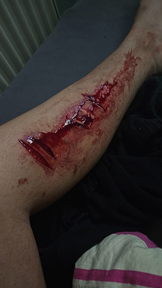 fletcherf16's tweet photo. Hi btches I'm alive 

#SELFHARMTRIGGERWARNING  #sh #shtwt #selfharmtw #ouchietwt #catscratchtwt  #fypシ #tw #edtw #ed #edshtwt #lgbt https://t.co/WBcegvh89z