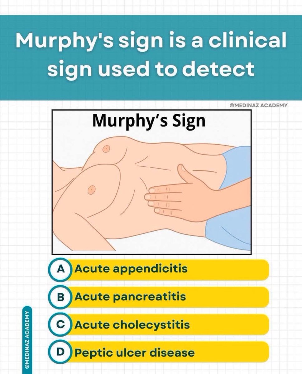 Murphy's sign is a clinical sign used to detect