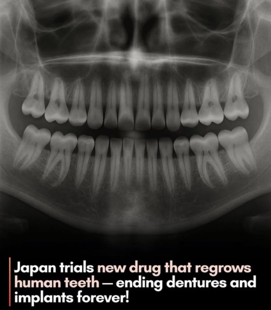 gunsnrosesgirl3's tweet image. Scientists in Japan have created a drug that lets humans regrow lost teeth naturally