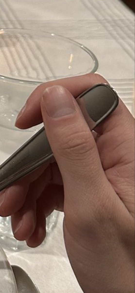 umami__papi's tweet image. The thumbnail’s imperfect convexity indicating ripping rather than clipping