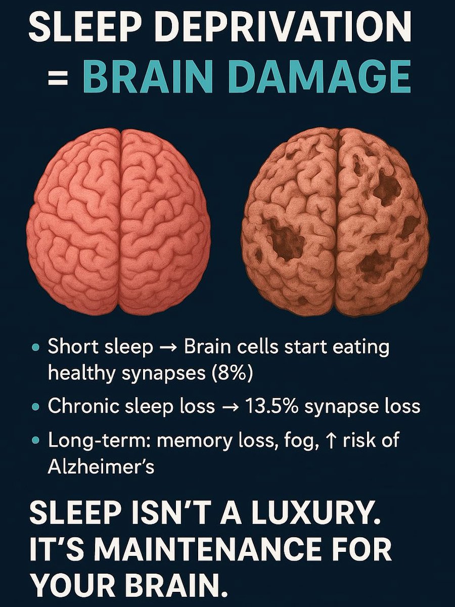 SIGNSGRD's tweet image. #Brain facts 
#SGRD SIGN 
#SIGN
#AAN