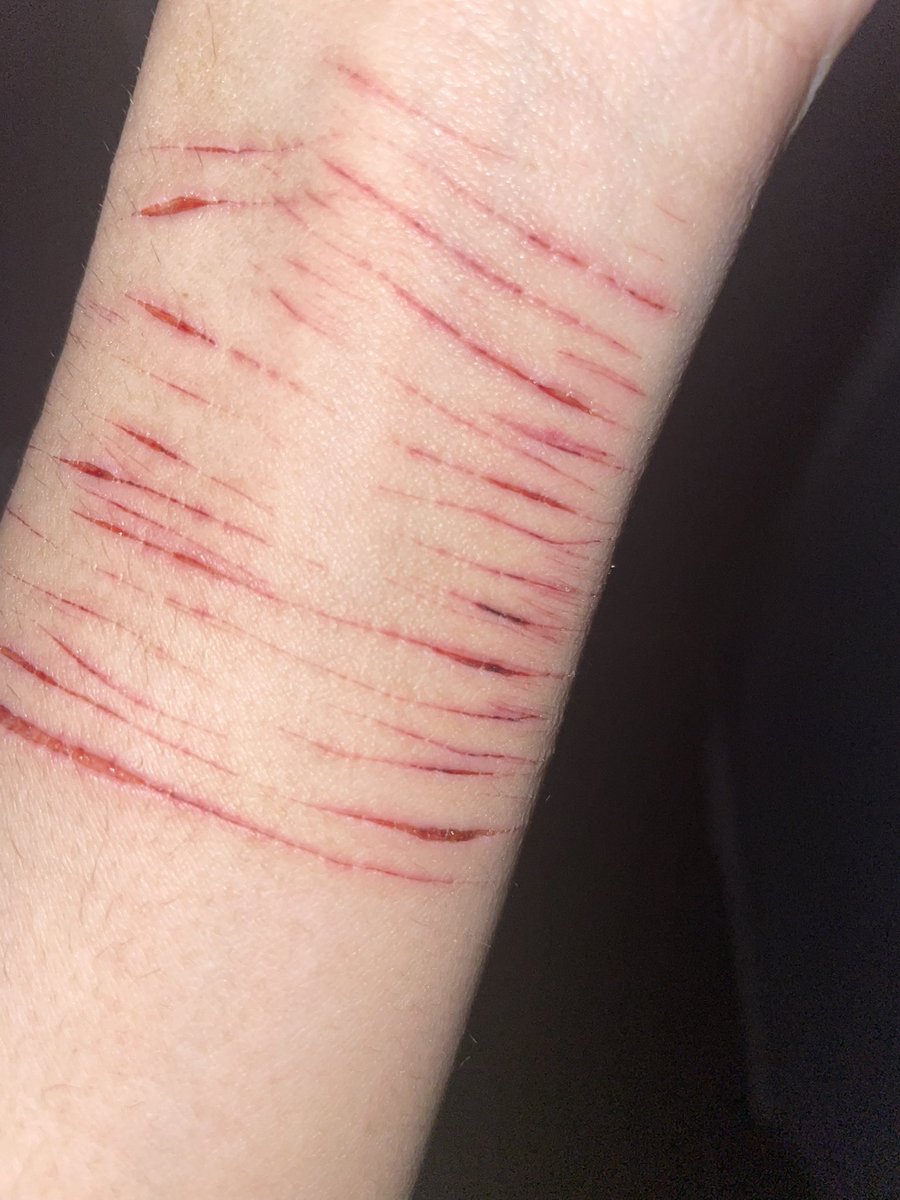 siwwylain's tweet photo. It’s so petty I wanna eat it #shtwtᅠ #selfharm #selfharmtw https://t.co/ETAE4BsI2t