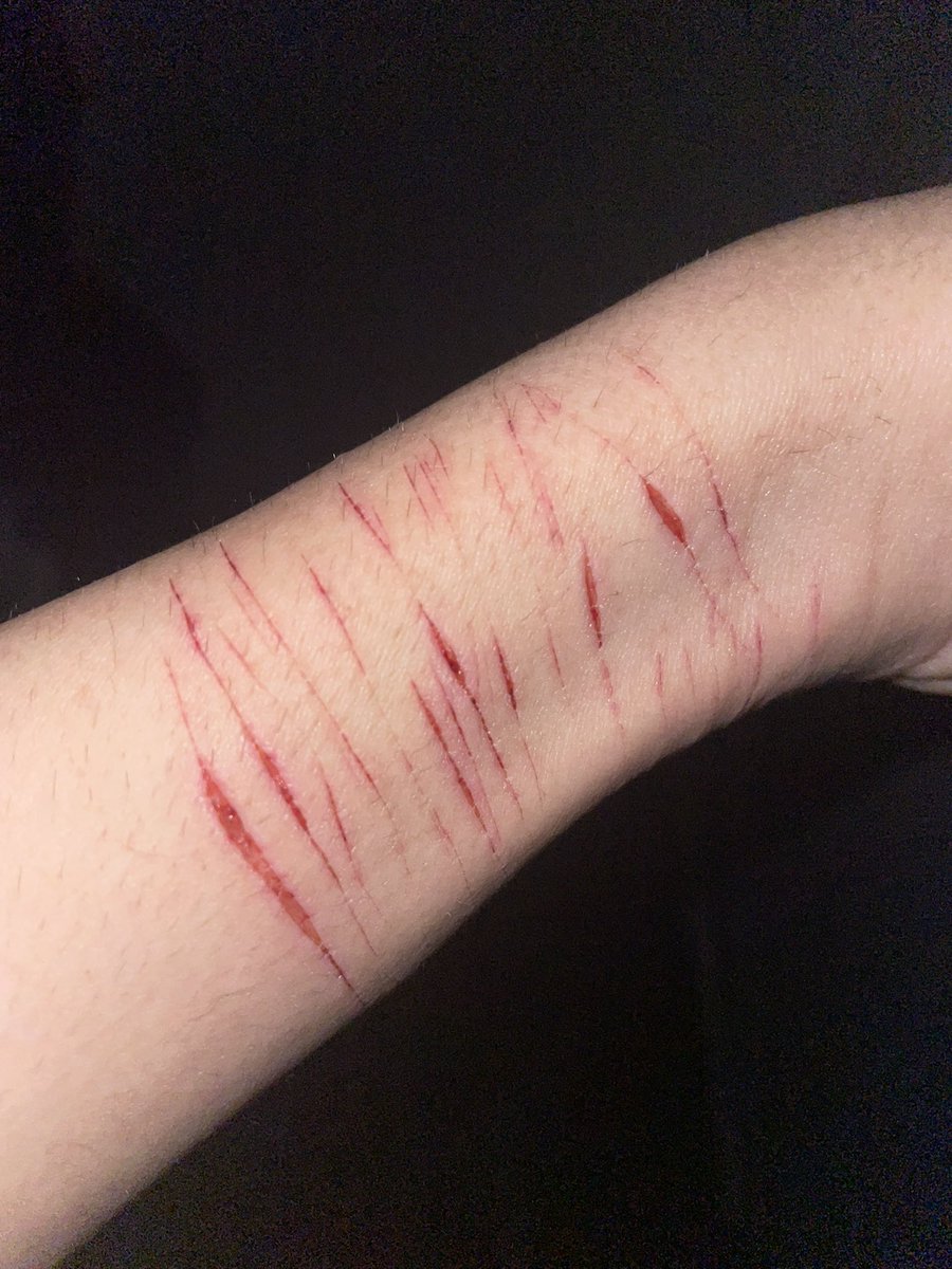 siwwylain's tweet photo. It’s so petty I wanna eat it #shtwtᅠ #selfharm #selfharmtw https://t.co/ETAE4BsI2t