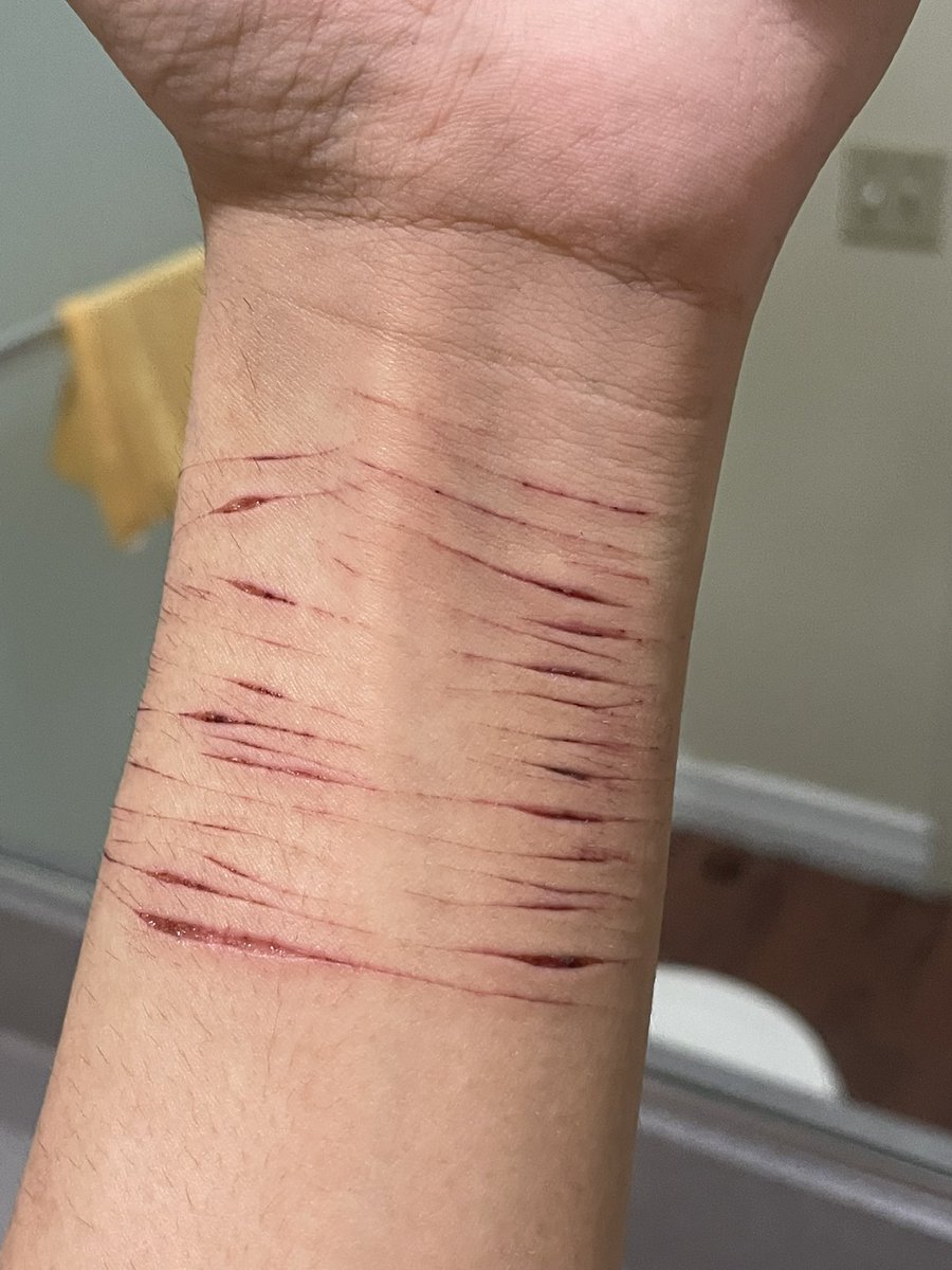 siwwylain's tweet photo. It’s so petty I wanna eat it #shtwtᅠ #selfharm #selfharmtw https://t.co/ETAE4BsI2t