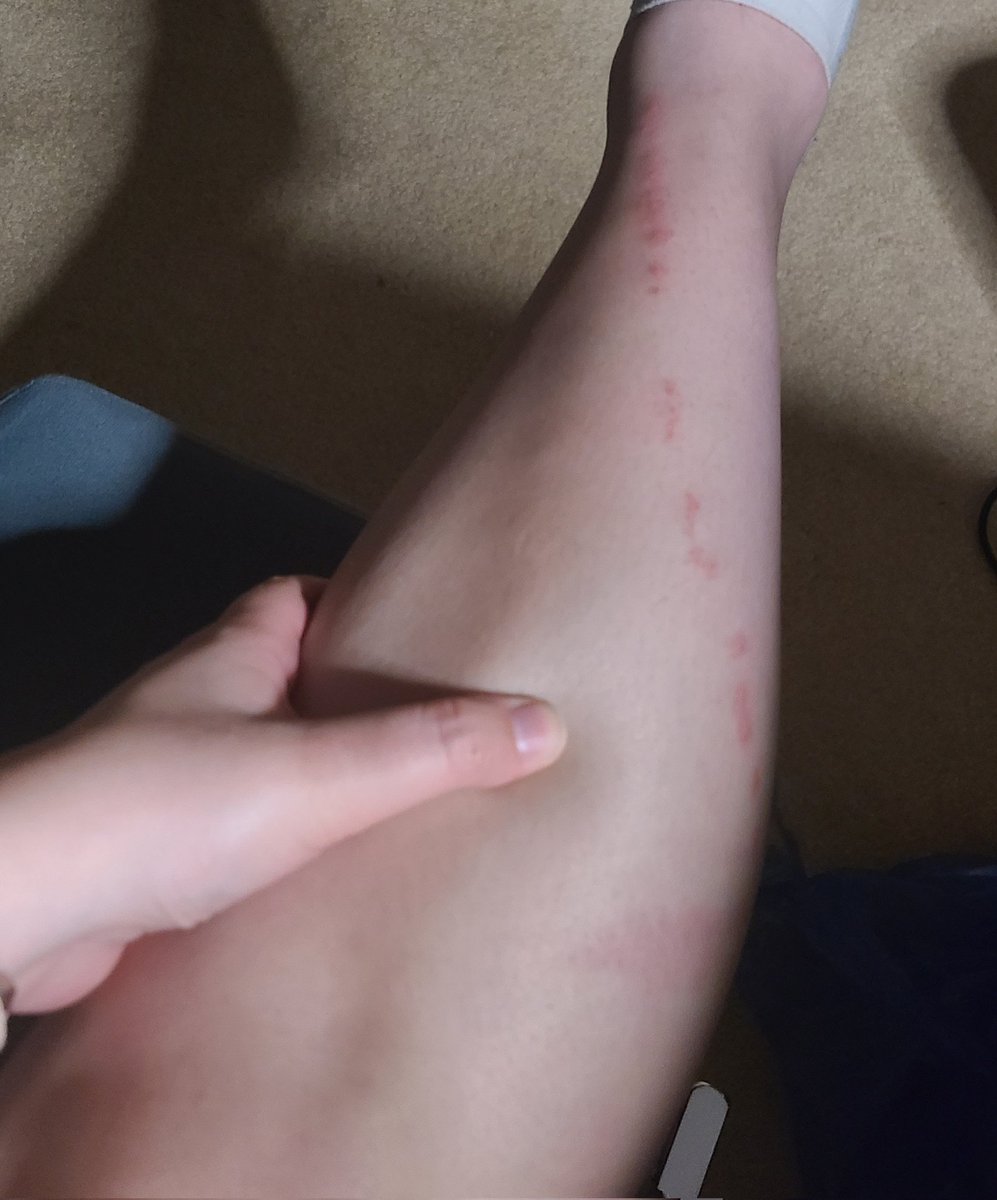 Anna Philipp tweet media