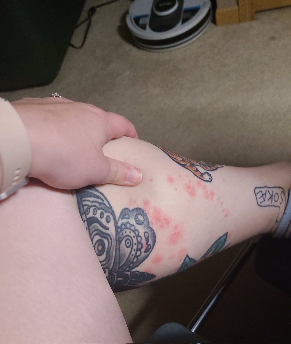 Anna Philipp tweet media