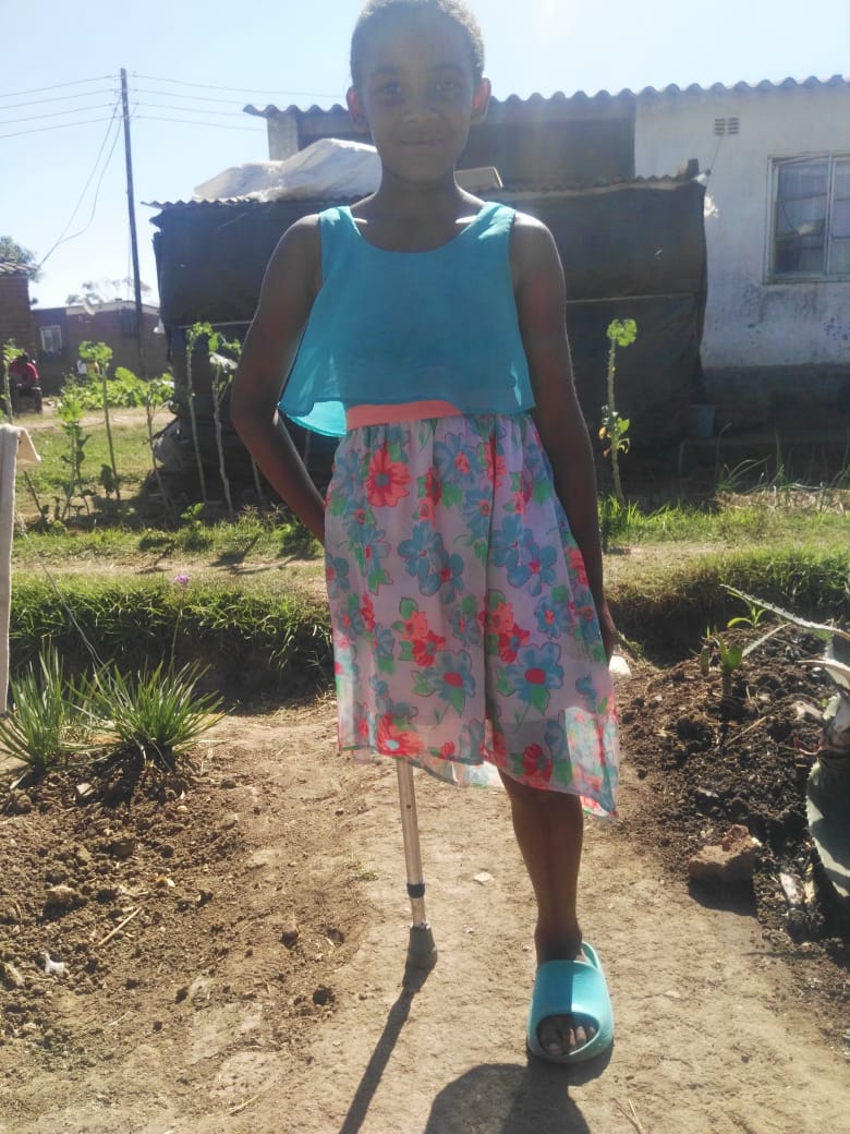 COZWVA!!

Let's help , Rufaro T Sesedza D.O.B. 29/05/14. She had an accident in 2019. Her leg had to be amputated.

The father is a civil servant &amp; he can not afford to buy it periodically as she needs prosthesis (artificial leg). It costs US$2 300 

Call 0776443239 to help her