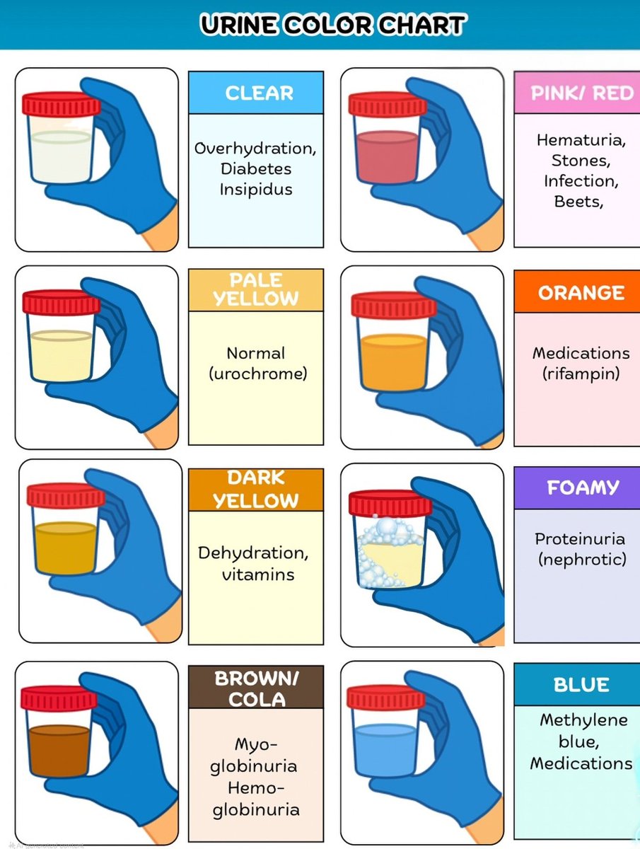 Doctors_GUILD's tweet photo. Urine colour Chart https://t.co/kPGGK1UqDK
