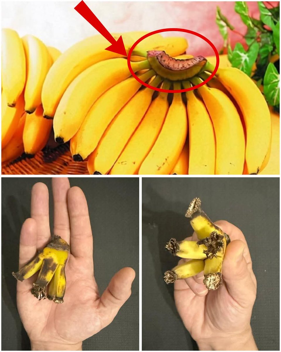 🍌 You’ll Never Throw Away This Part of the Banana Once You Discover Its Hidden Power… 😲✨

Yes, I’m talking about the banana peel! Don’t toss it—here’s why it’s a game-changer for your health, home, and beauty. 👇