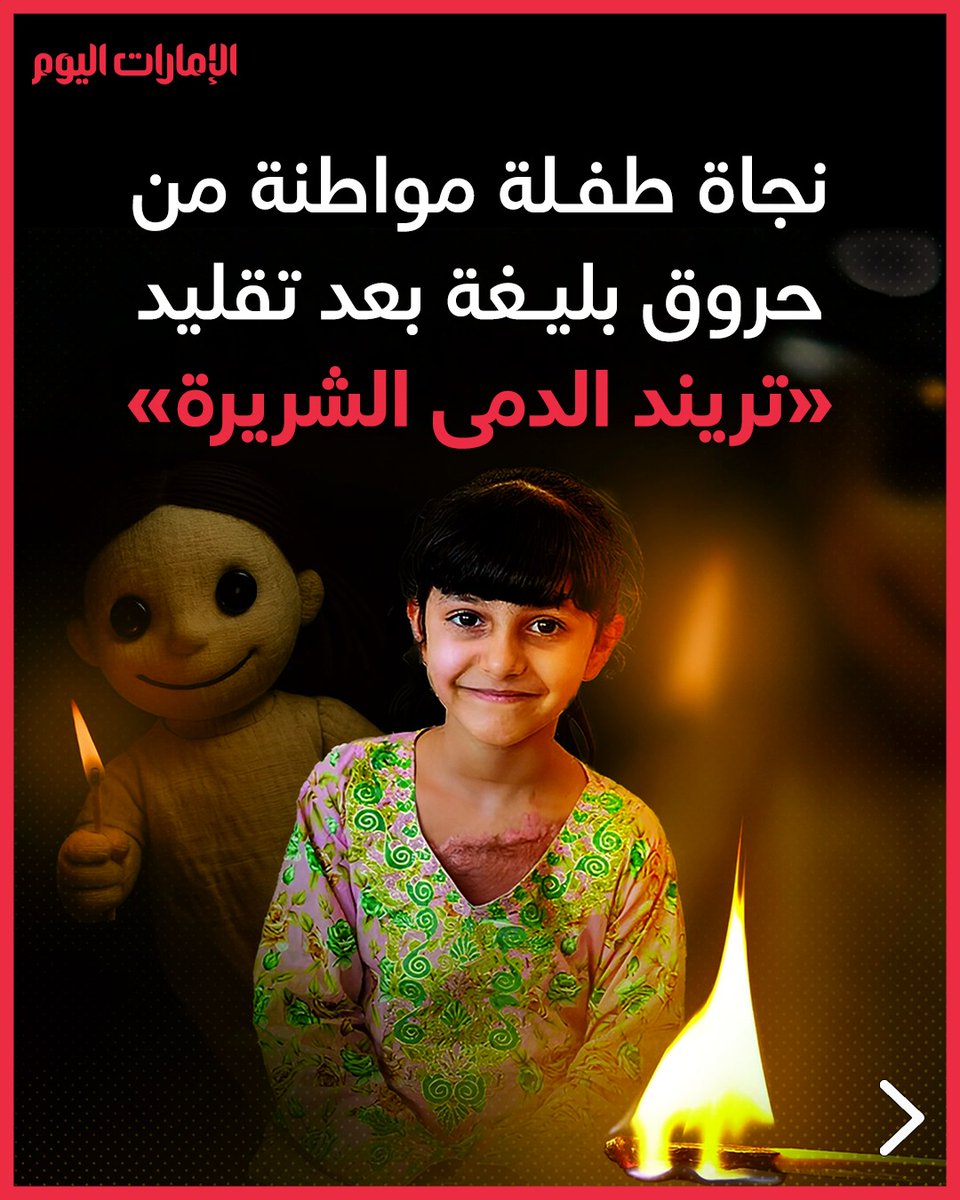 emaratalyoum's tweet image. نجاة طفلة مواطنة من حروق بليغة بعد تقليد «تريند الدمى الشريرة»
 للتفاصيل: trib.al/xjnDMc6

#الإمارات_اليوم