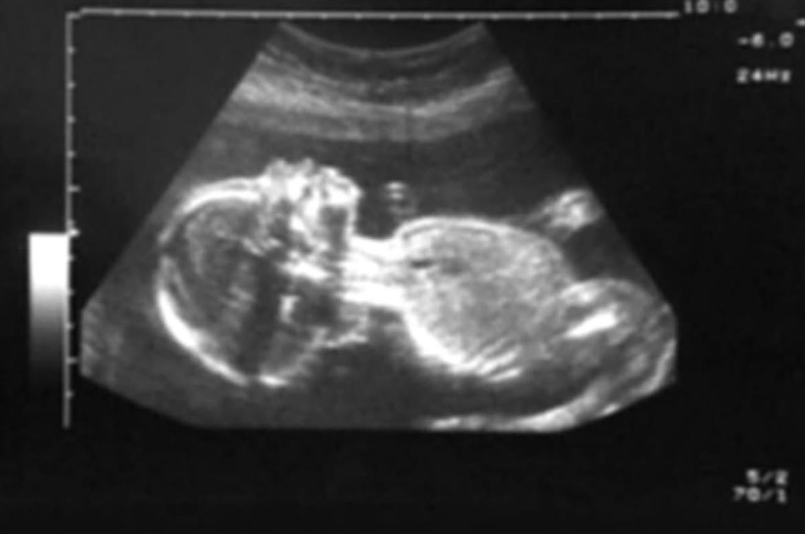 The Last Time I Had A Decent Amount Of Sleep..
