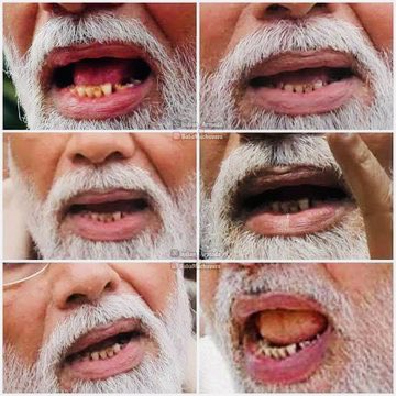 NayakRagini's tweet image. पसीना मल कर चेहरा चमकाया जा सकता है
तो…
गुटखे - तंबाकू से दांत क्यों नहीं ??? 🥴