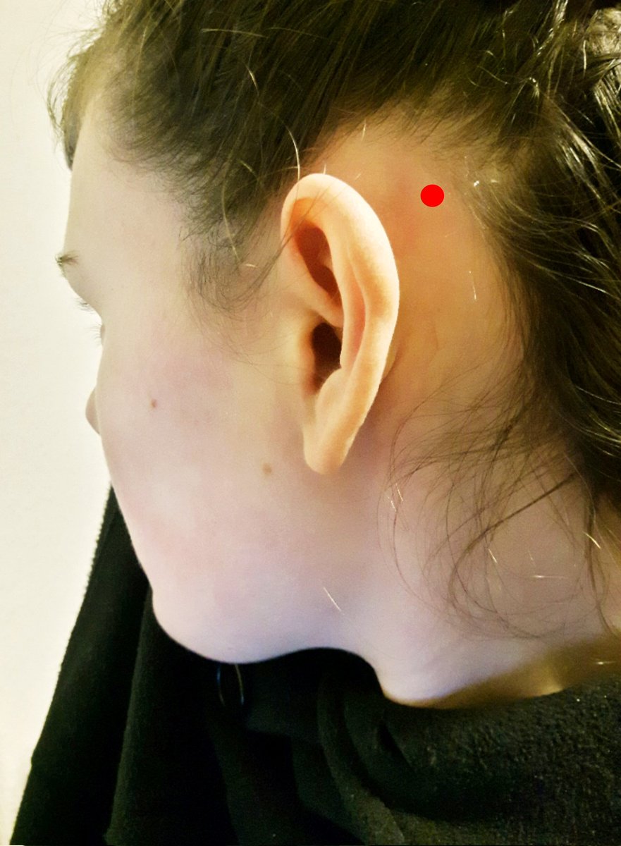 Wisst ihr was ich mich seit Jahrzehnten frage?

Warum gibt es eigentlich hinter den Ohren einen Bereich bei dem keine Haare wachsen?