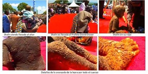 The power of the blood of Jesus.
#HealingFromMozambique