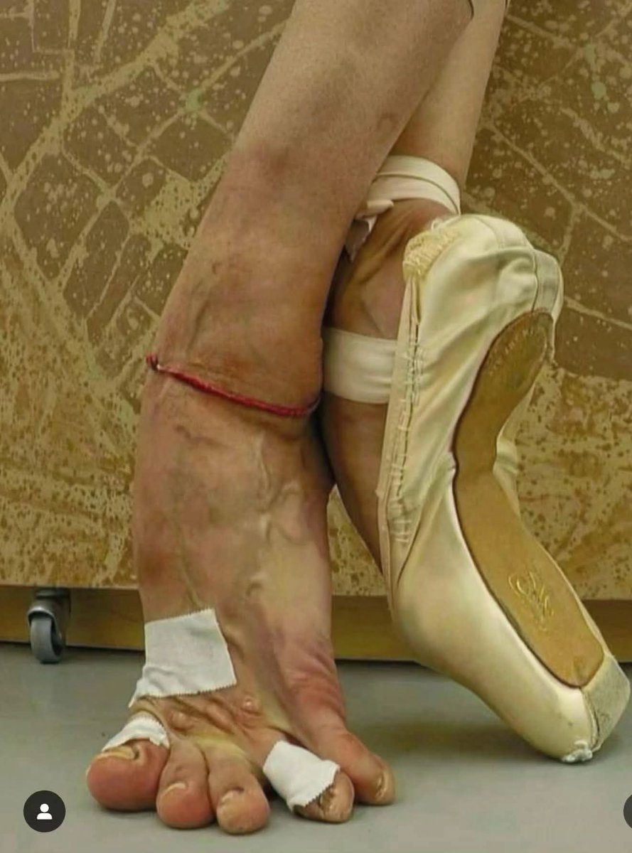 RogelioGalvn2's tweet image. This is what the feet of a professional ballet dancer with Years of experience look like. 

&quot;Wanting to be the best at something comes at a price, but it&apos;s the path to excellence.&quot;

#SundayThoughts