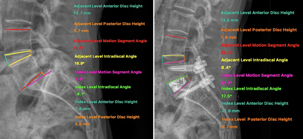 Journal of Neurosurgery tweet media