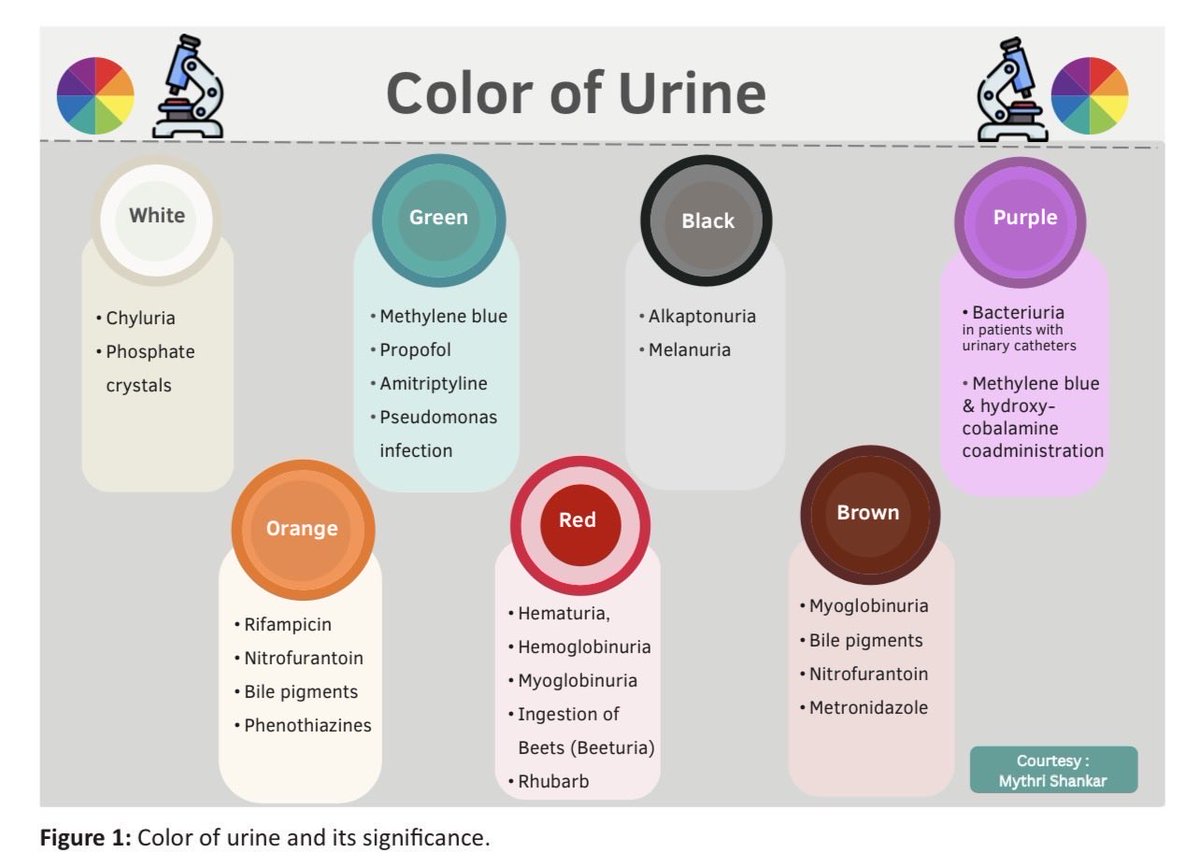 adolf_nava's tweet image. 💧#Urianalisis : La biopsia líquida #Kidney

#Orina es una ventana a los riñones 🫘

Desde el blanco hasta el morado, el jarabe de arce hasta el moho, y los glóbulos rojos hasta los cristales: ¡cada tono, aroma y célula cuenta una historia!

🔗doi.org/10.25259/IJN_6

#Nephrology