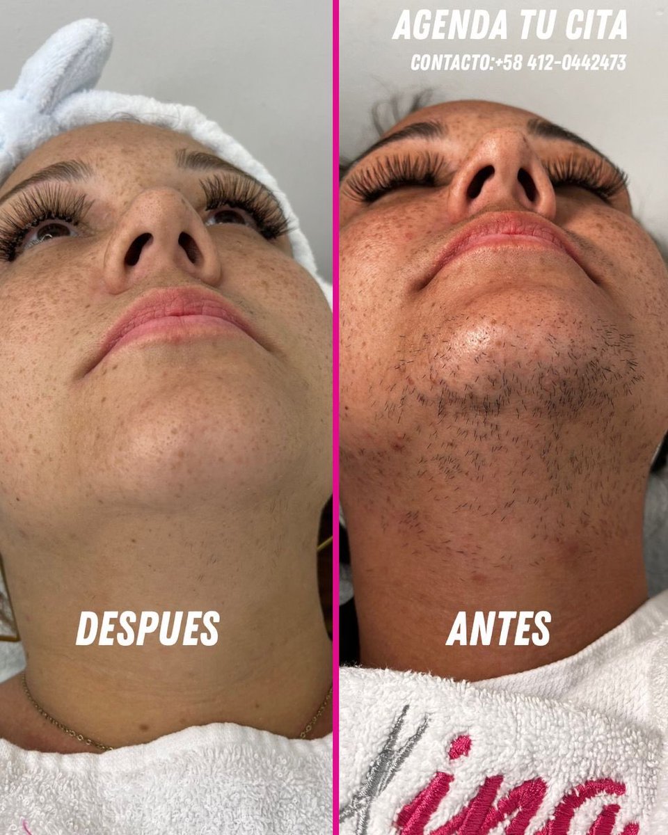 Antes y después que valen la pena ⚡️