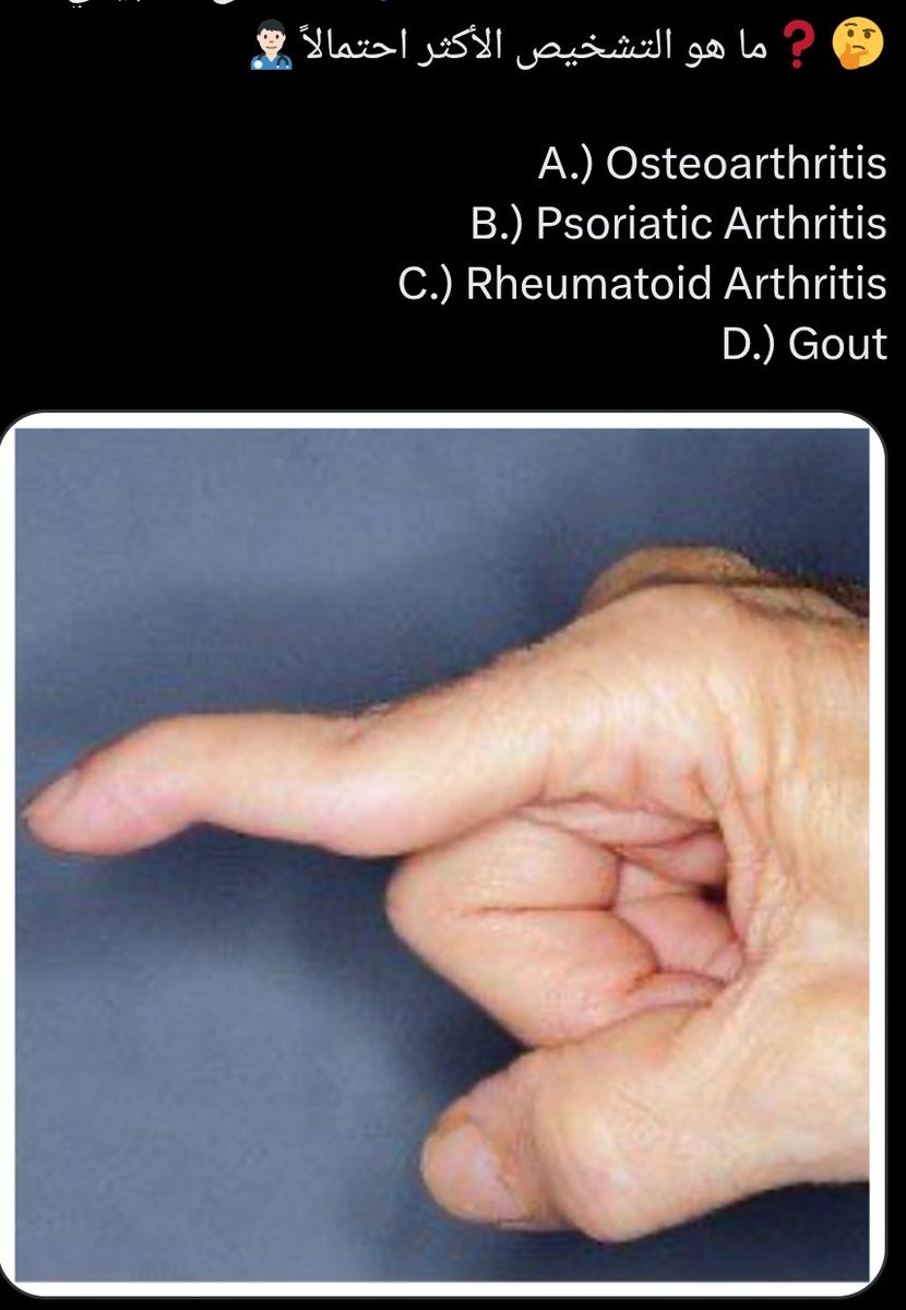 SamierSara38451's tweet photo. #Orthopedic Students_Review

Extensor tendon compartments https://t.co/8umZv2zwcR