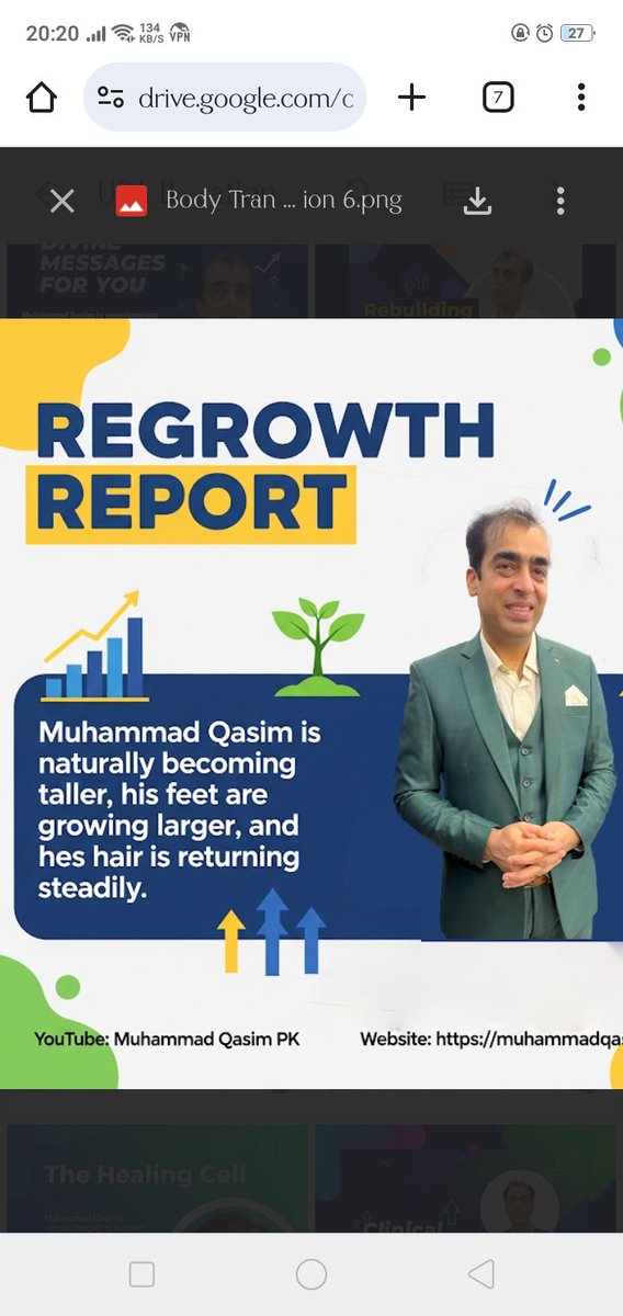 An extra ordinary case of Muhammad Qasim in the history of medial science.